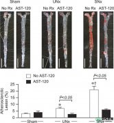 【研究】口服活性炭吸附剂（AST-120）改善载脂蛋白E缺陷小鼠肾脏疾病加速的动