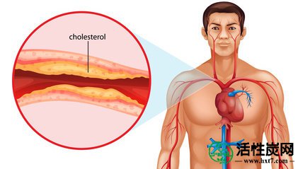 可以活化木炭控制胆固醇水平？